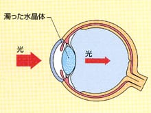 目の模型